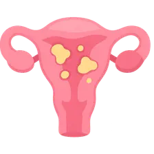 Sexually Transmitted Infections