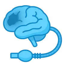 Anesthesia for Traumatic Brain Injury
