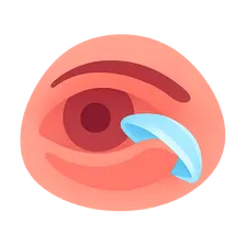 Contact Lens Complications