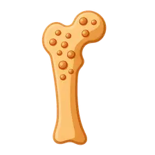 Hyperparathyroidism