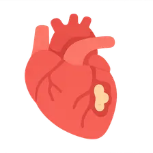 Ischemic Heart Disease Imaging