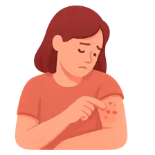 Excoriation (Skin-Picking) Disorder