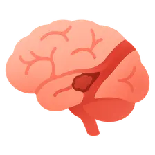 Vascular Diseases in Specific Organs
