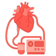 Cardiopulmonary Bypass Principles
