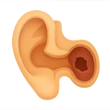 Chronic Otitis Media