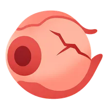 Classification of Ocular Trauma