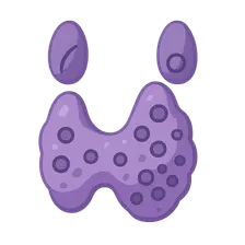 Multiple endocrine neoplasia syndromes