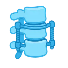 Spinal fusion procedures