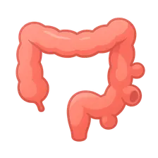 Diverticular disease