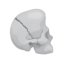 Temporal Bone Fractures