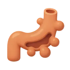 Diverticular Disease
