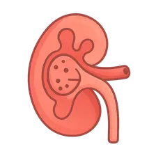 Nephritic syndrome