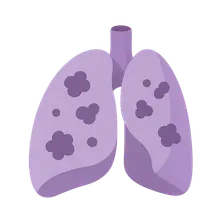 Management of Metastatic Disease