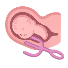 Operative vaginal delivery
