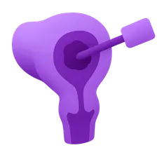 Brachytherapy