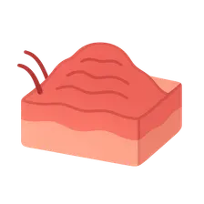 Fibrosis and Repair