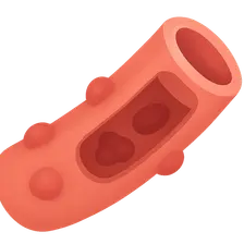 Small vessel vasculitis