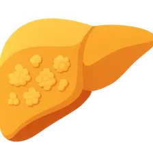 Glycogen Storage Diseases