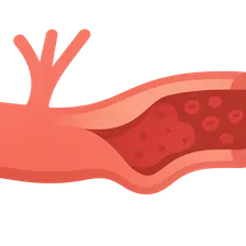 Ischemia-reperfusion injury