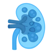 Nephrotic syndrome