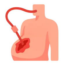 Abdominal Trauma Management
