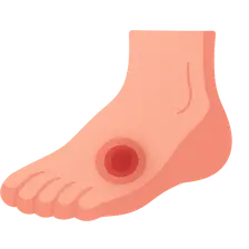 Diabetic Foot