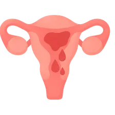 Abnormal Uterine Bleeding: Classification