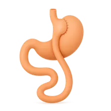 Roux-en-Y Gastric Bypass