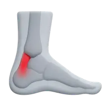 Achilles Tendon Disorders