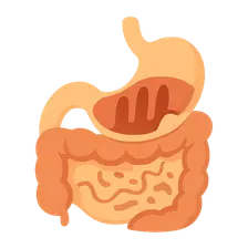 Malabsorption Syndromes