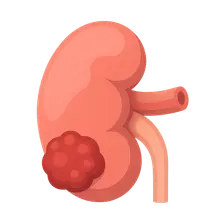 Renal tumors
