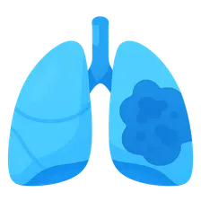 Pulmonary complications