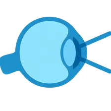 Refractive Errors