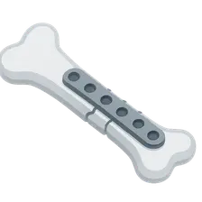 Plate Osteosynthesis