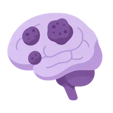 Metastatic CNS tumors