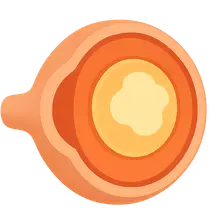 Age-Related Cataract