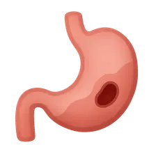 Peptic ulcer disease