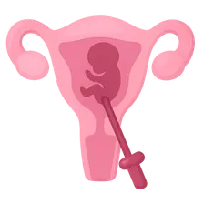 Medical Termination of Pregnancy