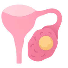 Ovulatory Disorders