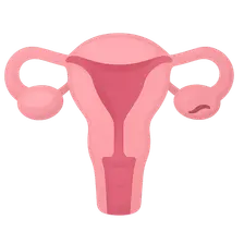 Secondary Amenorrhea