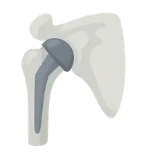 Shoulder Arthroplasty