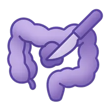 Cytoreductive Surgery