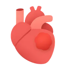 Cardiac tumors