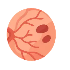 Retinal Vascular Diseases