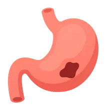 Gastrointestinal perforation