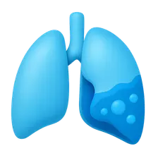 Pleural Diseases