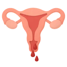 Abnormal Uterine Bleeding