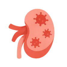 Post-transplant infections