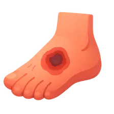 Diabetic Foot Infections