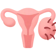 Hyperandrogenism